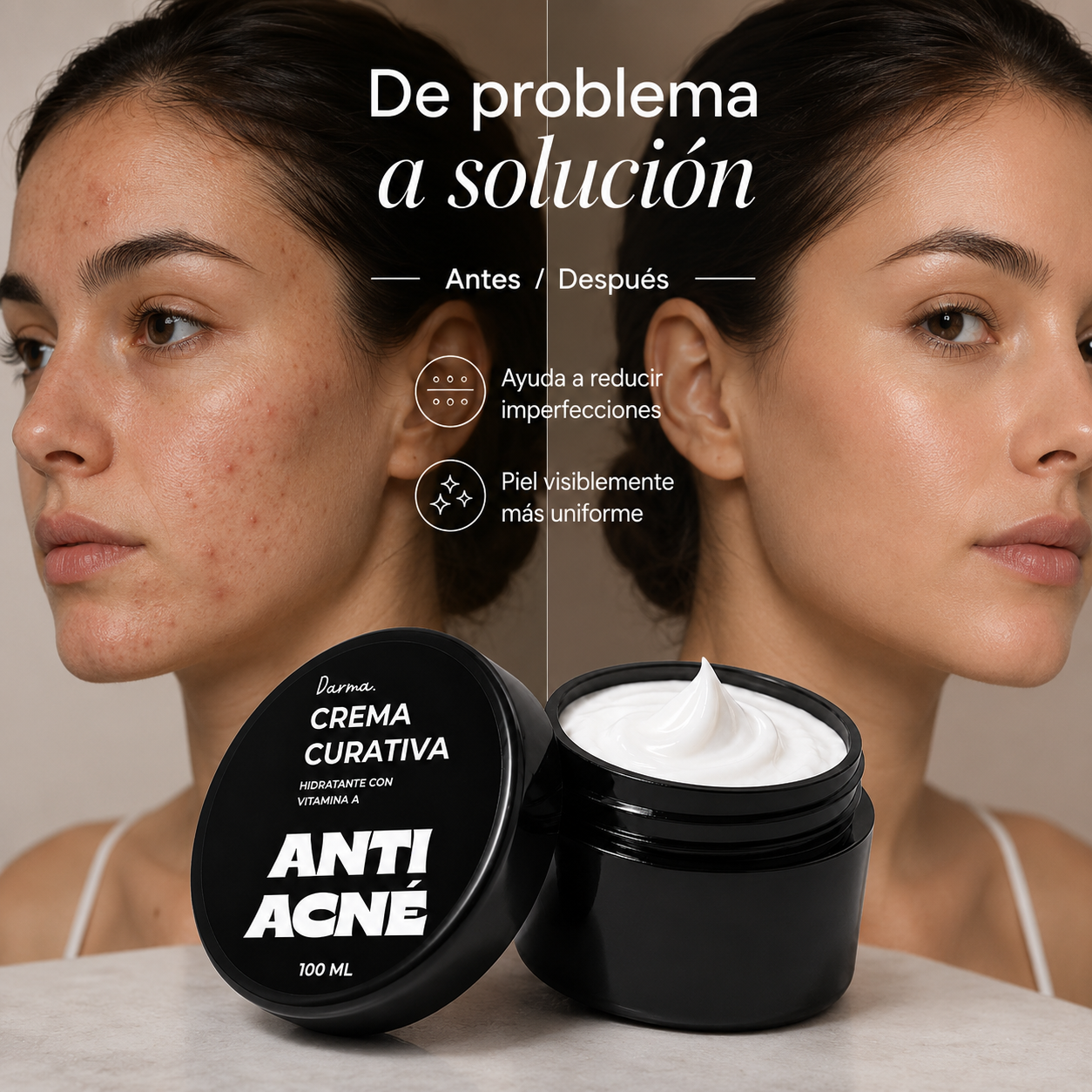 Crema Curativa Darma Professional Antiacné con Vitamina A 100 ml